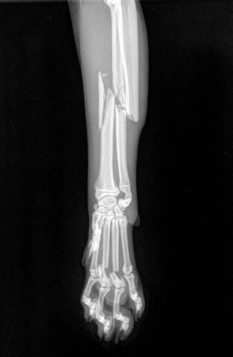 Chirurgie orthopédique