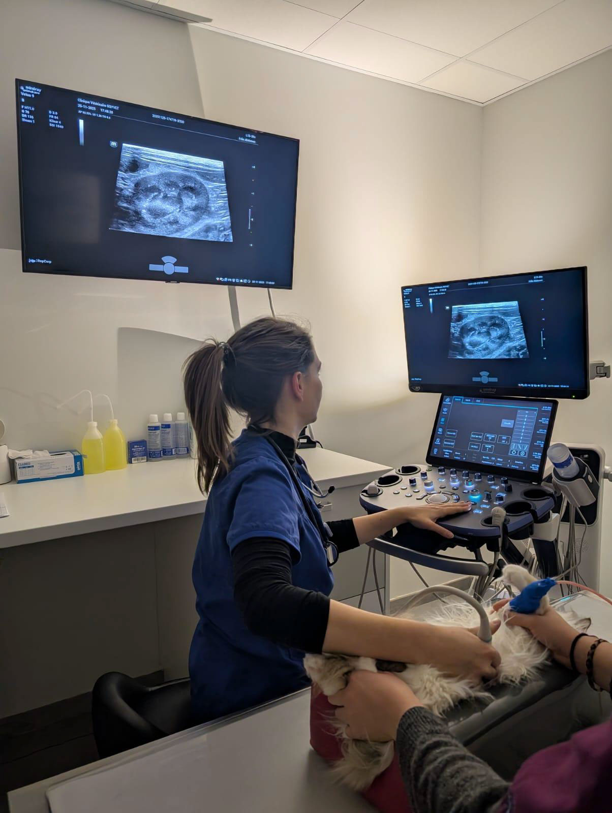 Echographie abdominale